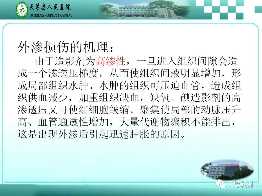 影像PPT - 【PPT】碘造影剂外渗的预防及处理-4