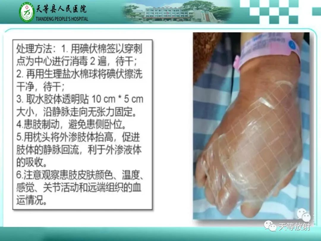影像PPT - 【PPT】碘造影剂外渗的预防及处理-20