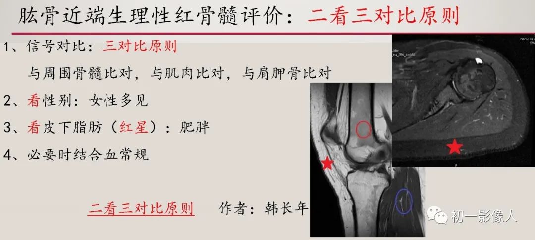 影像PPT - 【PPT】肱骨近端生理性红骨髓识别-13 影像PPT - 【PPT】肱骨近端生理性红骨髓识别-13