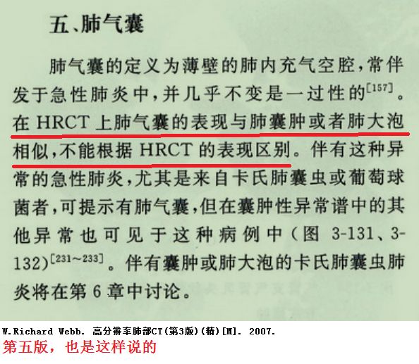 影像PPT - 肺大泡、肺气肿、肺的气囊、囊肿、空洞,CT如何鉴别-8 影像PPT - 肺大泡、肺气肿、肺的气囊、囊肿、空洞,CT如何鉴别-8