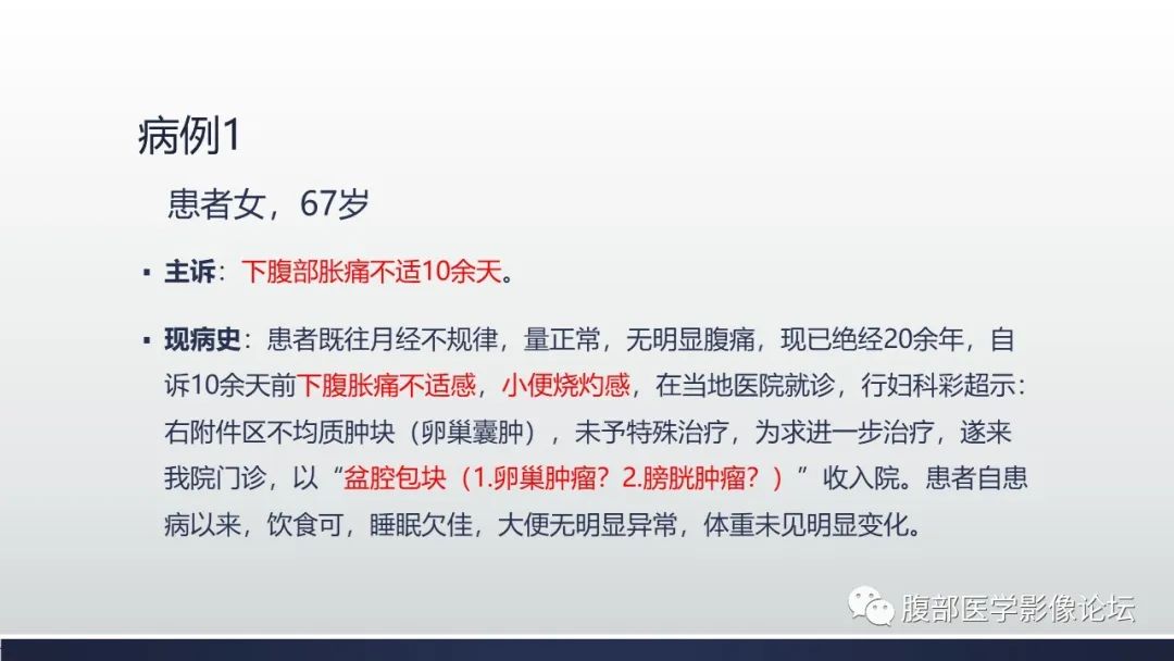 影像PPT - 【病例】脐尿管癌1例CT影像表现及鉴别诊断-2
