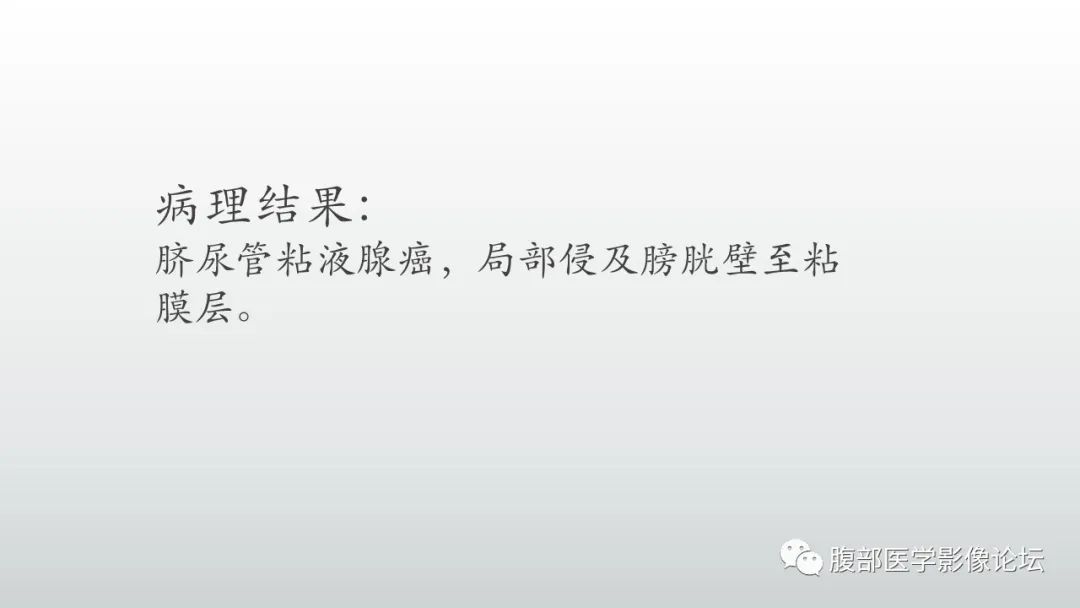 影像PPT - 【病例】脐尿管癌1例CT影像表现及鉴别诊断-9