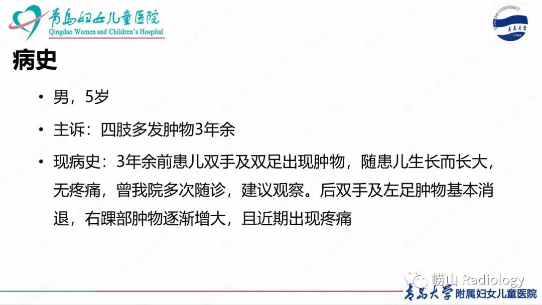 影像PPT - 【病例】半肢骨骺发育不良1例X线CT及MR-2