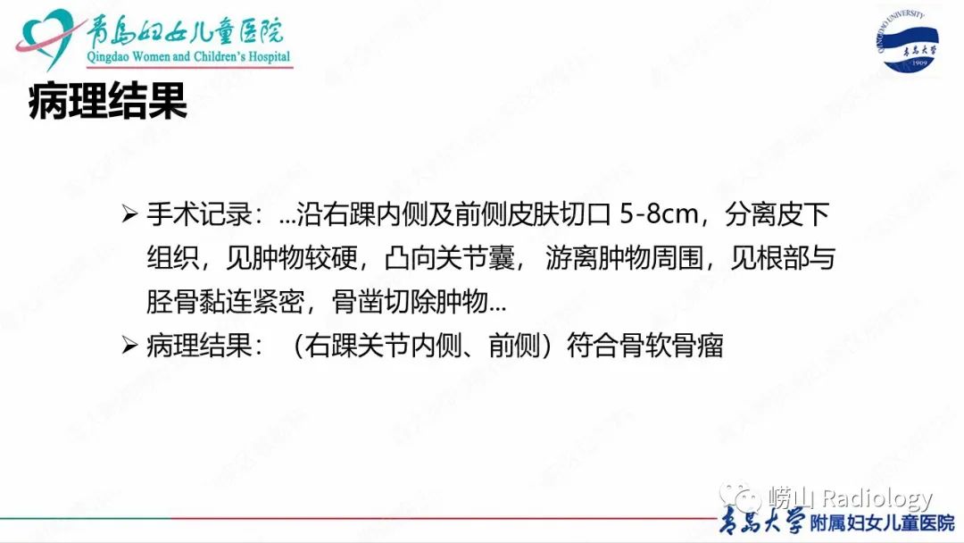 影像PPT - 【病例】半肢骨骺发育不良1例X线CT及MR-11