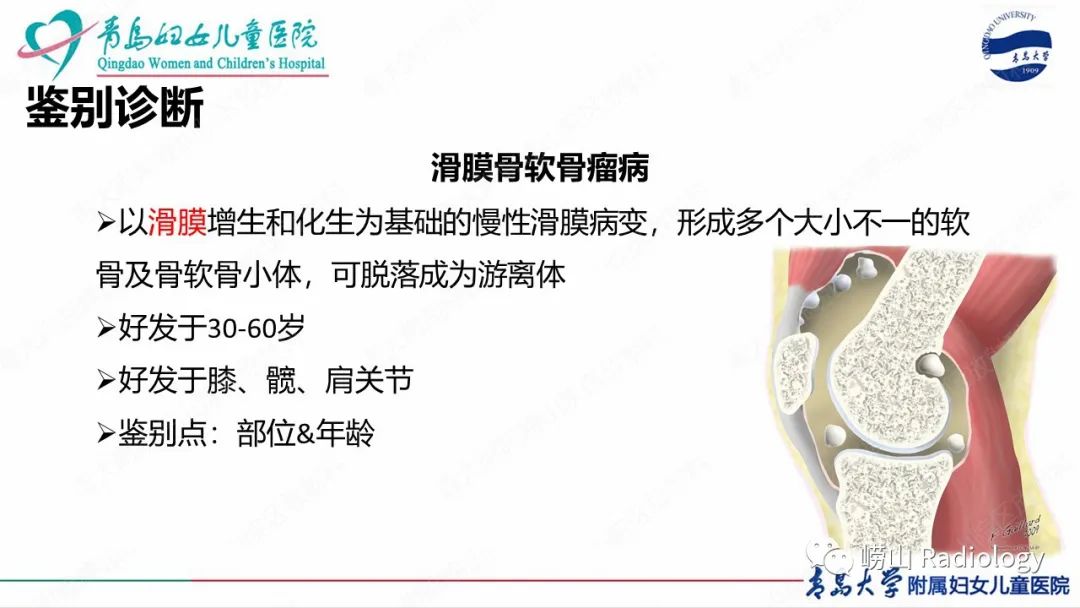 影像PPT - 【病例】半肢骨骺发育不良1例X线CT及MR-21