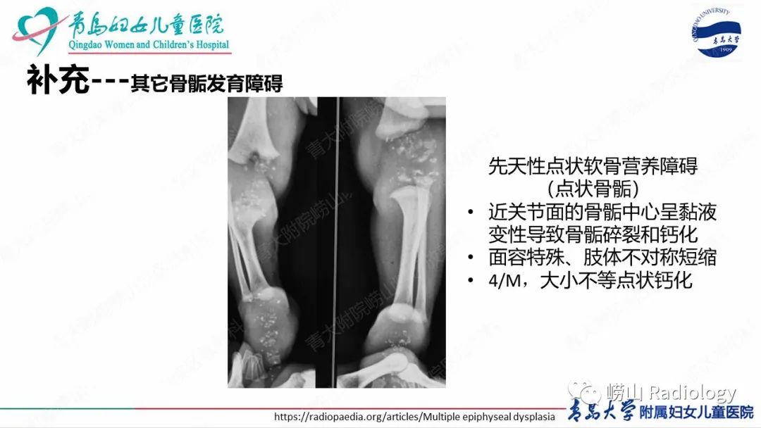 影像PPT - 【病例】半肢骨骺发育不良1例X线CT及MR-25