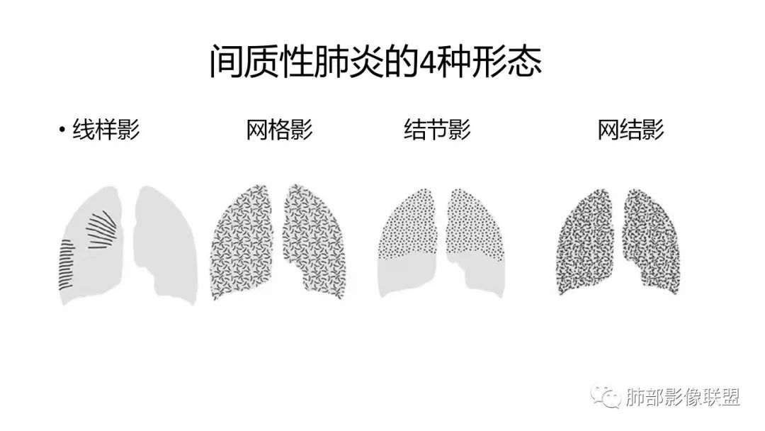 影像PPT - 【PPT】肺炎影像的三个基础问题-10 影像PPT - 【PPT】肺炎影像的三个基础问题-10