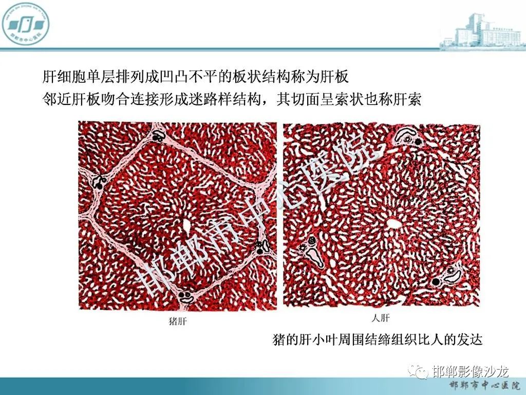 影像PPT - 【PPT】肝脏解剖、病理及影像的一点感悟-4
