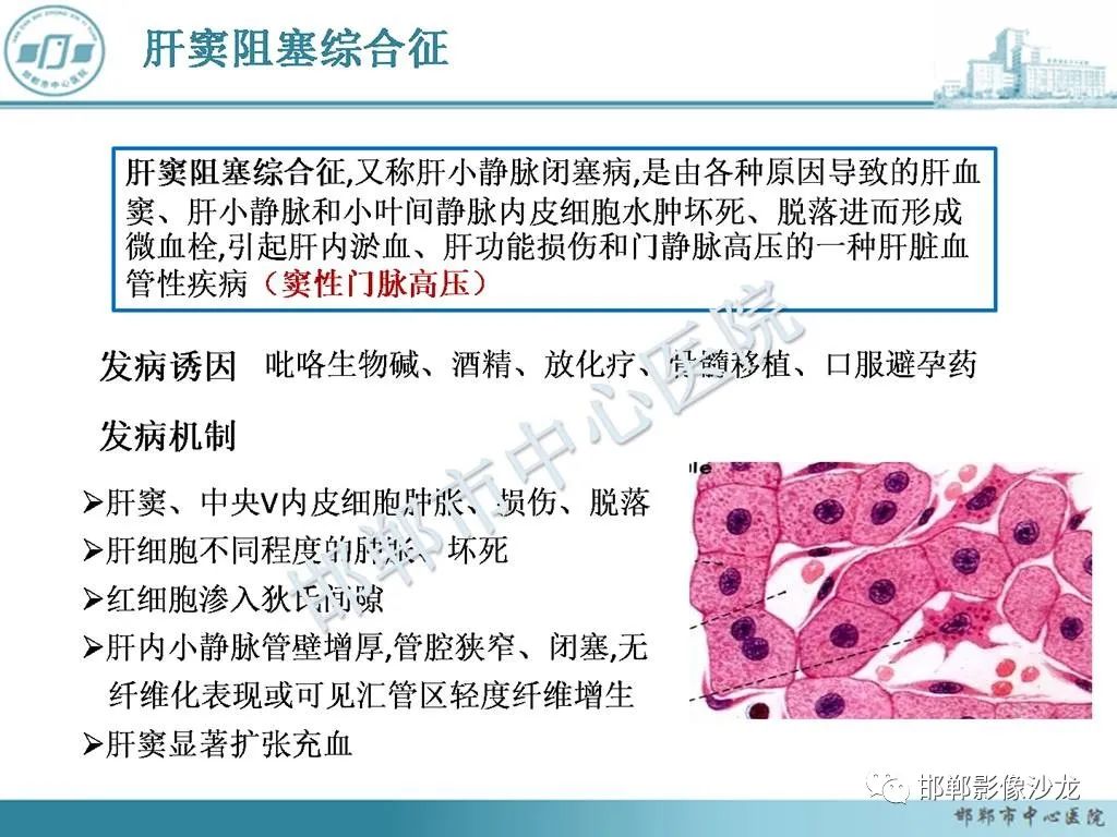 影像PPT - 【PPT】肝脏解剖、病理及影像的一点感悟-17
