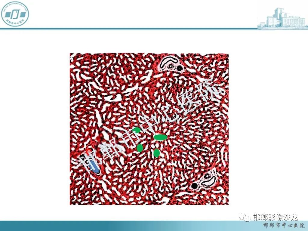 影像PPT - 【PPT】肝脏解剖、病理及影像的一点感悟-18