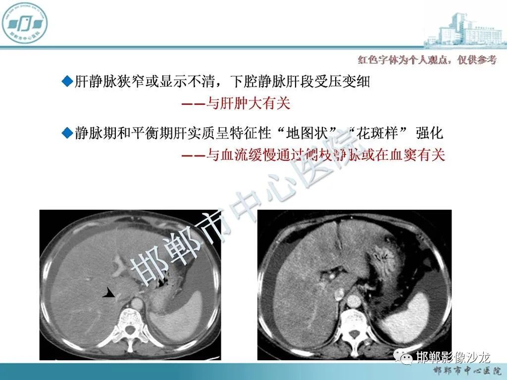 影像PPT - 【PPT】肝脏解剖、病理及影像的一点感悟-22