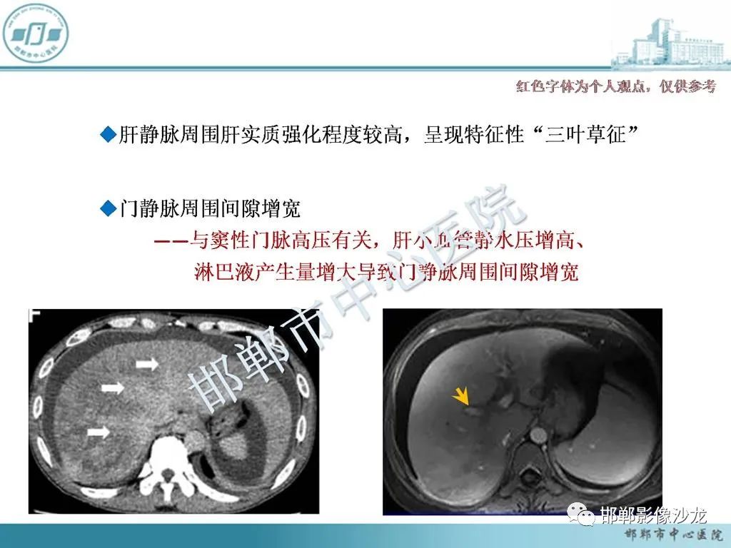 影像PPT - 【PPT】肝脏解剖、病理及影像的一点感悟-23