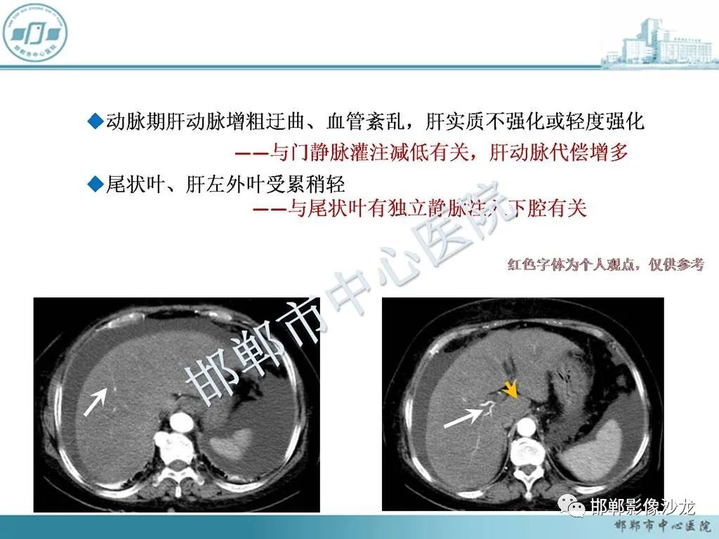 影像PPT - 【PPT】肝脏解剖、病理及影像的一点感悟-21