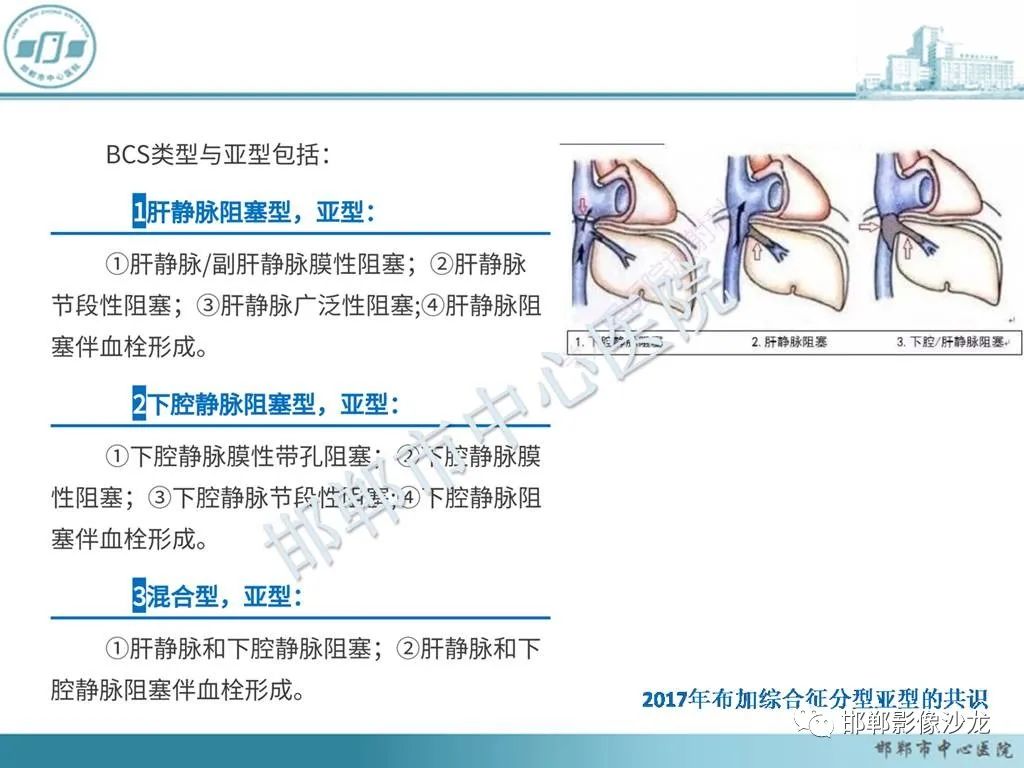 影像PPT - 【PPT】肝脏解剖、病理及影像的一点感悟-26
