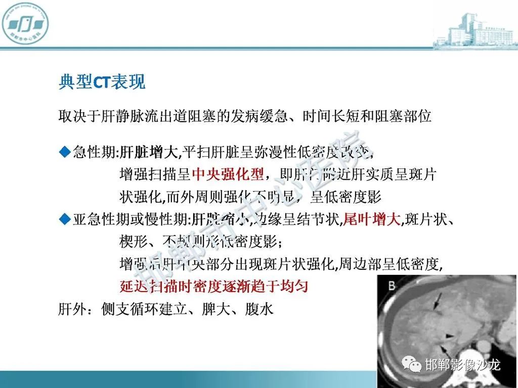 影像PPT - 【PPT】肝脏解剖、病理及影像的一点感悟-27