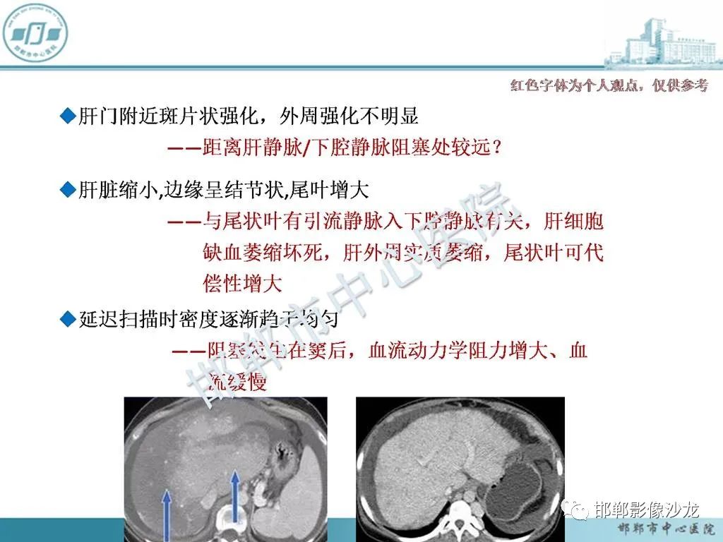 影像PPT - 【PPT】肝脏解剖、病理及影像的一点感悟-29