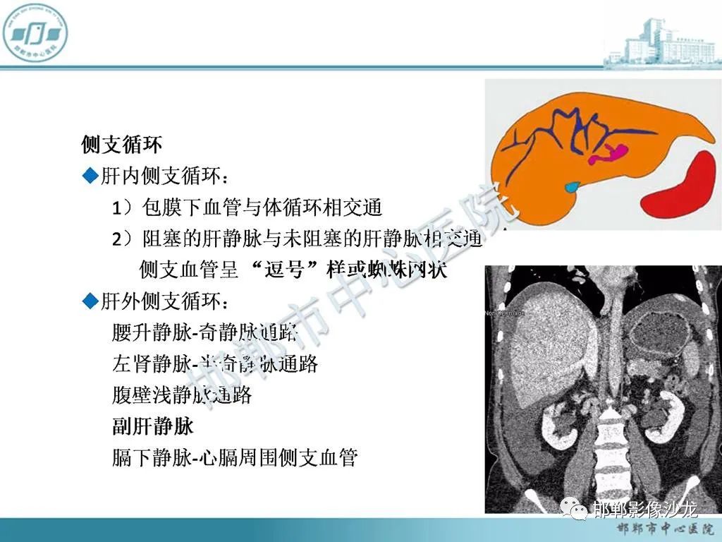 影像PPT - 【PPT】肝脏解剖、病理及影像的一点感悟-28