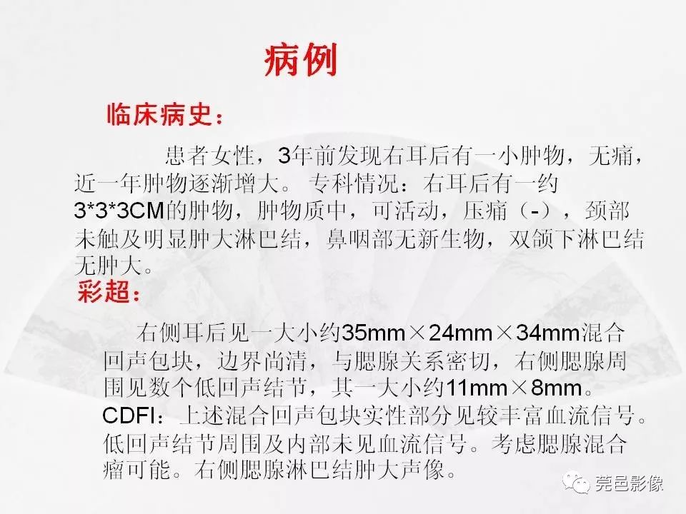 影像PPT - 【PPT】腮腺粘液表皮样癌的CT诊断与鉴别-2