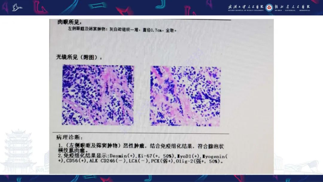 影像PPT - 【PPT】儿童眼眶肿瘤及肿瘤样病变影像诊断-4