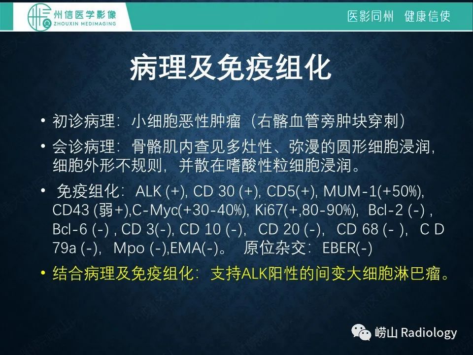 影像PPT - 【病例】腰大肌淋巴瘤1例PET/CT及MR影像-8