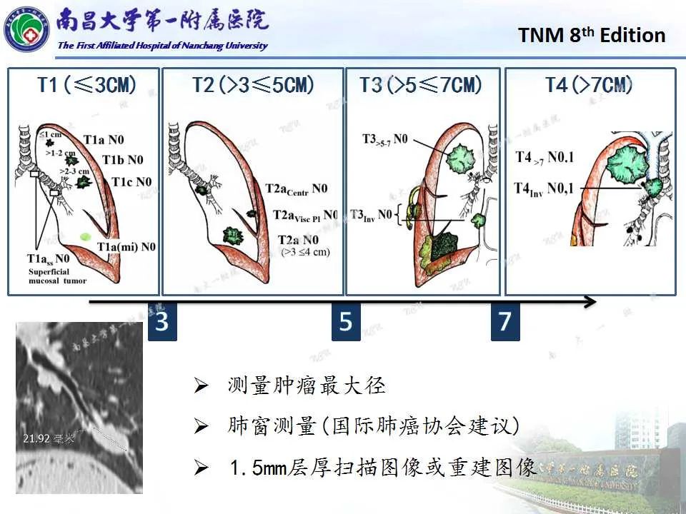 影像PPT - 【PPT】肺癌TNM分期 第8版-5