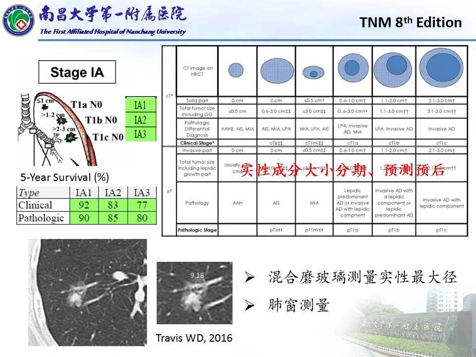 影像PPT - 【PPT】肺癌TNM分期 第8版-6