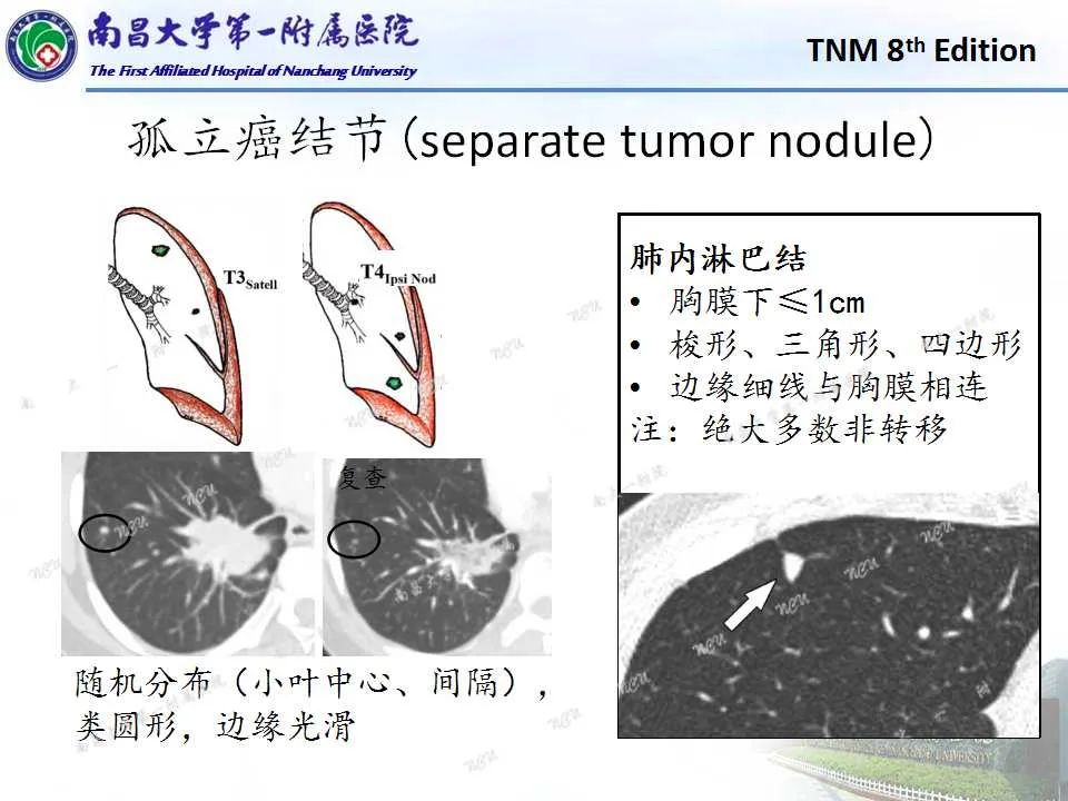 影像PPT - 【PPT】肺癌TNM分期 第8版-10