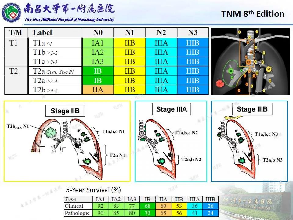 影像PPT - 【PPT】肺癌TNM分期 第8版-13