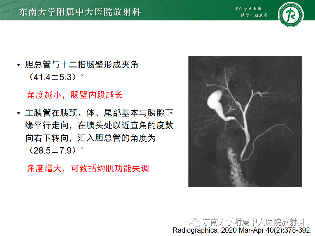 影像PPT - 【PPT】胰胆管合流异常-5
