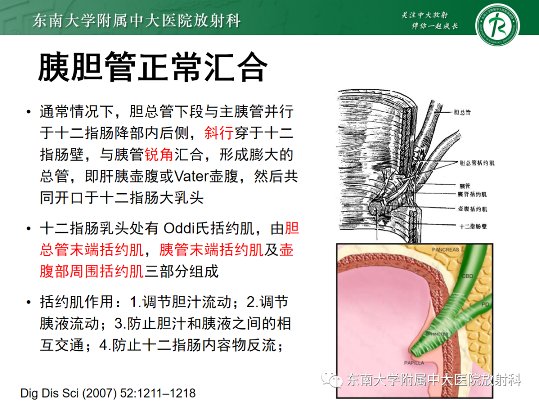 影像PPT - 【PPT】胰胆管合流异常-4