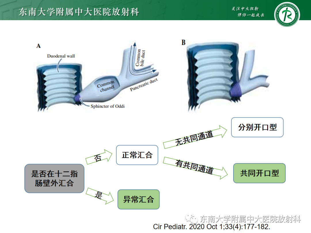 影像PPT - 【PPT】胰胆管合流异常-6