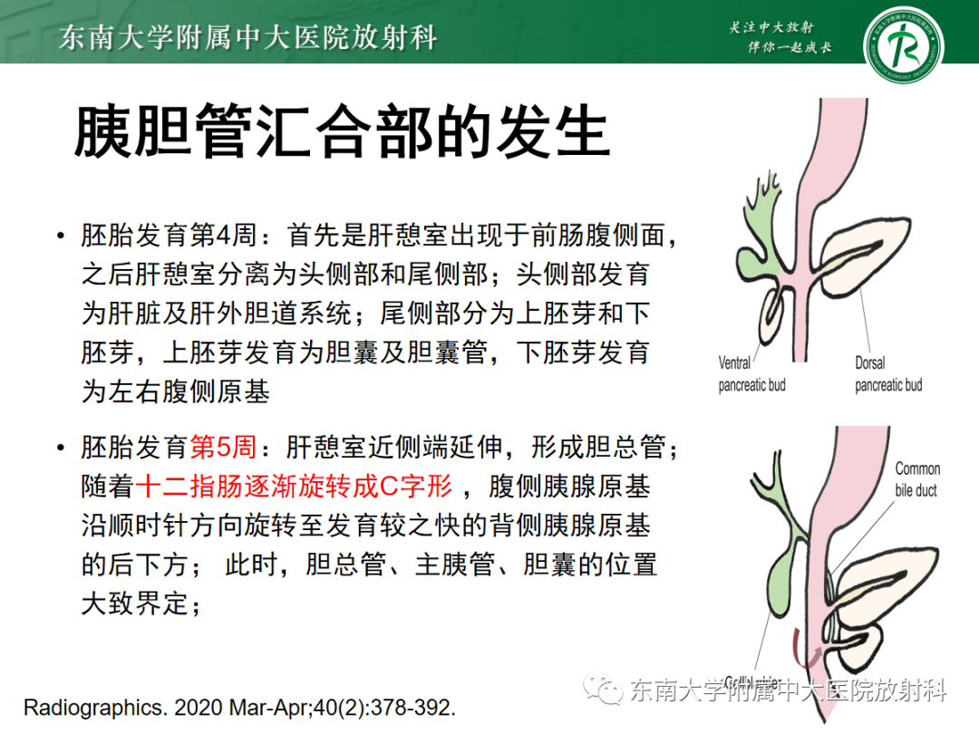 影像PPT - 【PPT】胰胆管合流异常-10