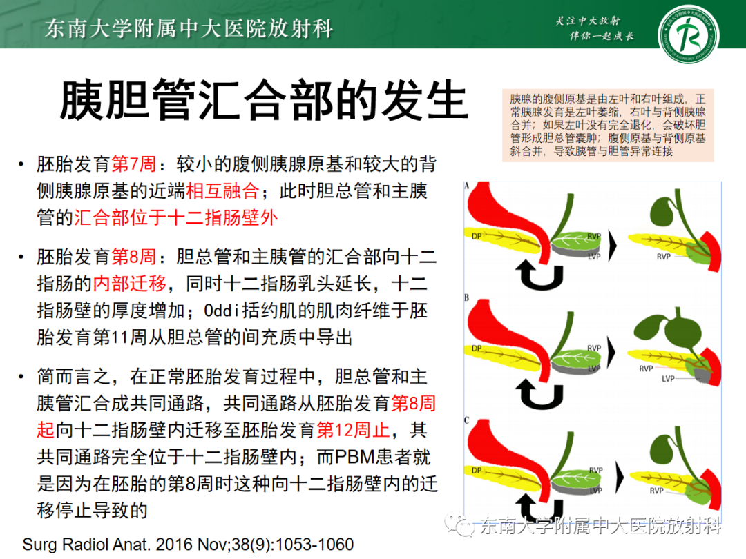 影像PPT - 【PPT】胰胆管合流异常-11