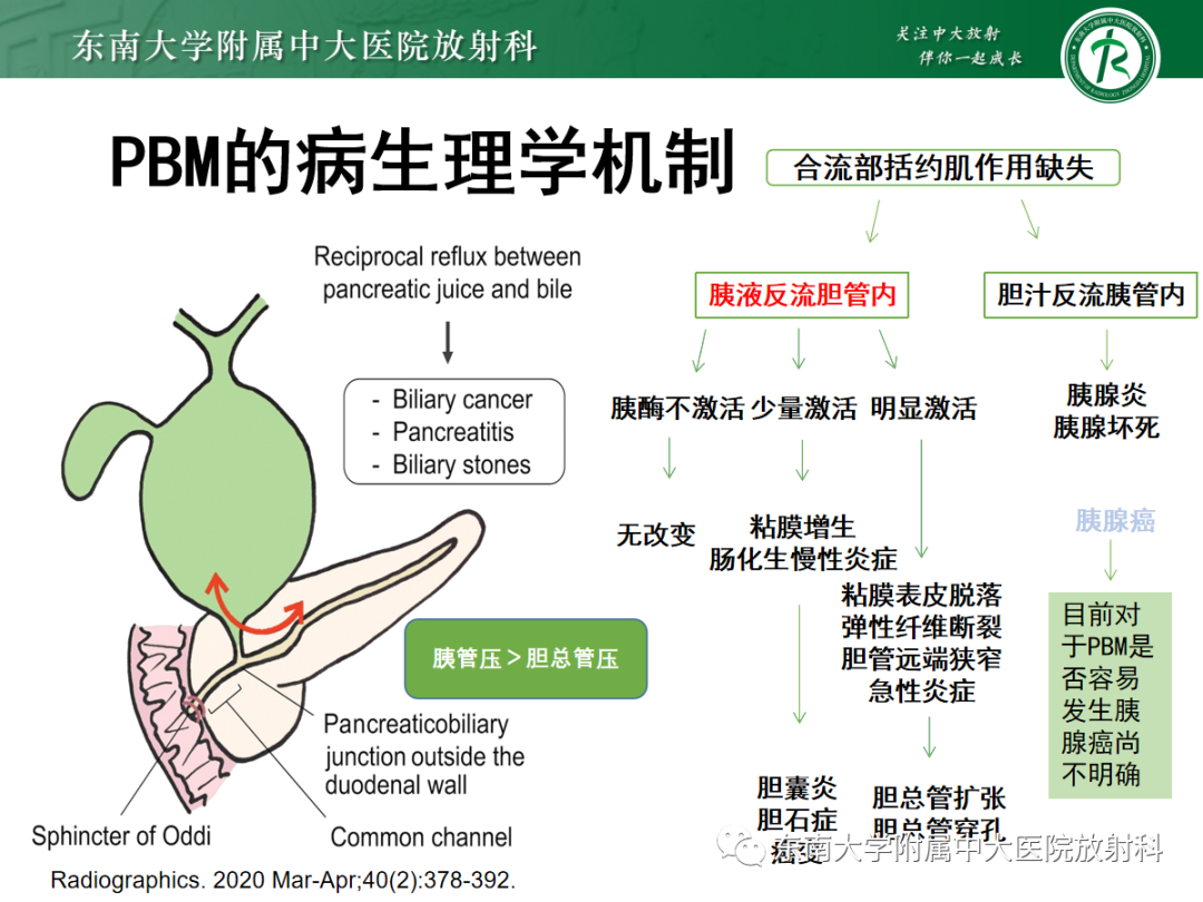 影像PPT - 【PPT】胰胆管合流异常-12