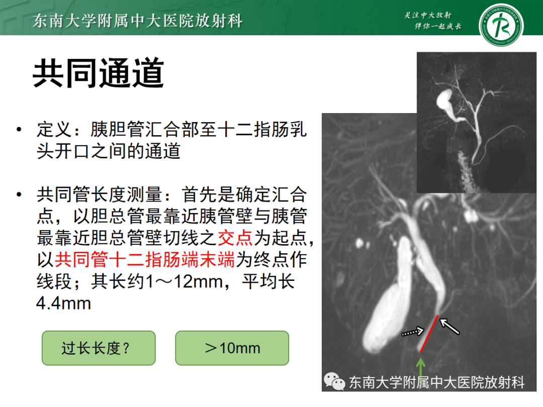 影像PPT - 【PPT】胰胆管合流异常-16