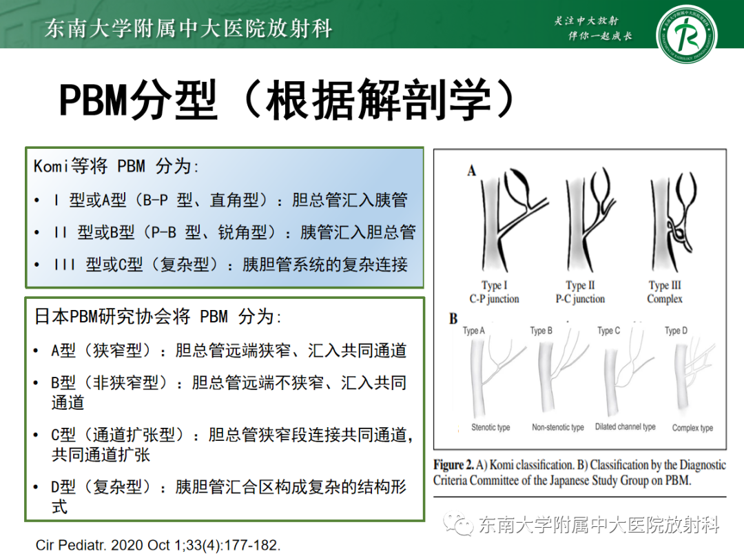 影像PPT - 【PPT】胰胆管合流异常-19