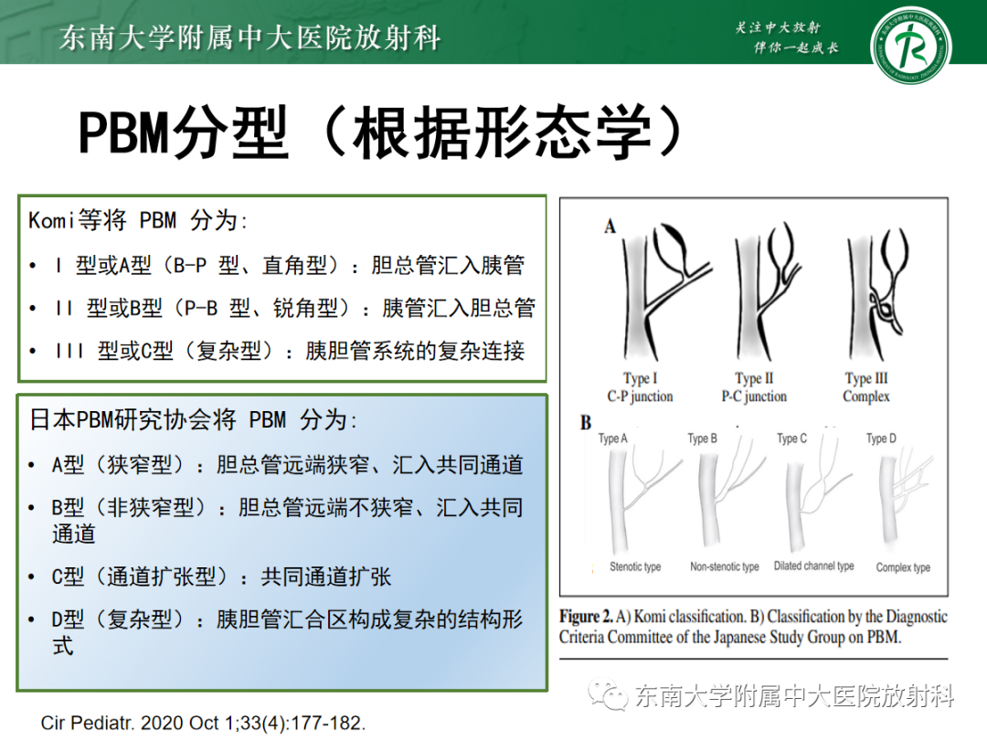 影像PPT - 【PPT】胰胆管合流异常-23