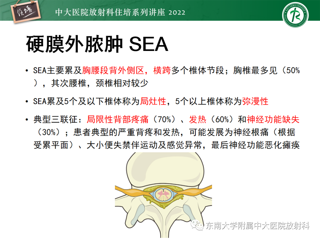 影像PPT - 【PPT】椎管内硬膜外间隙病变影像诊断思路-31