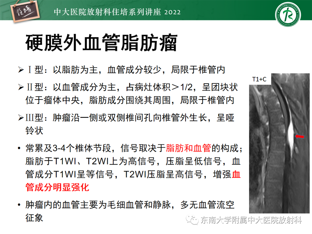 影像PPT - 【PPT】椎管内硬膜外间隙病变影像诊断思路-48