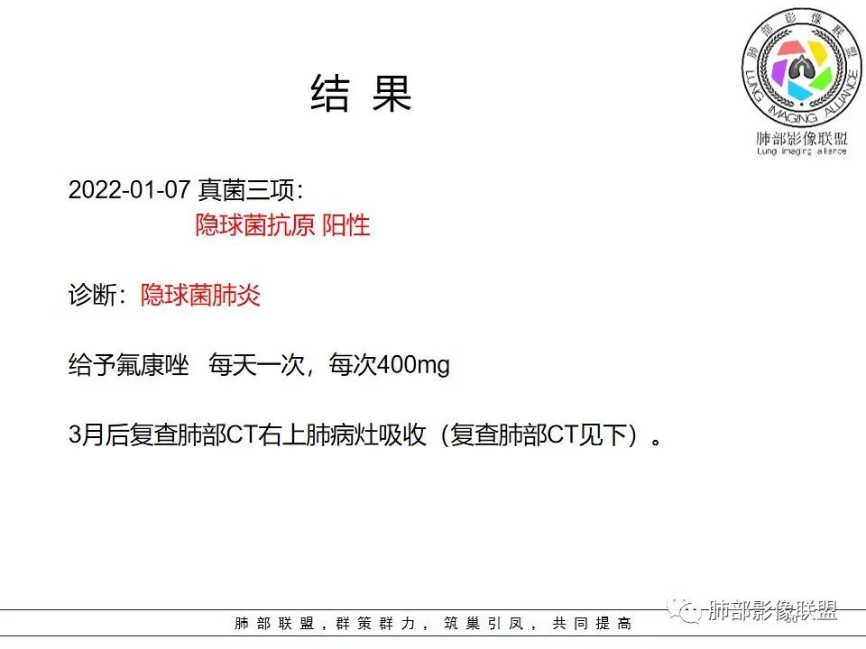 影像PPT - 【每日晨读】典型的胸膜下病变—隐球菌肺炎-55 影像PPT - 【每日晨读】典型的胸膜下病变—隐球菌肺炎-55