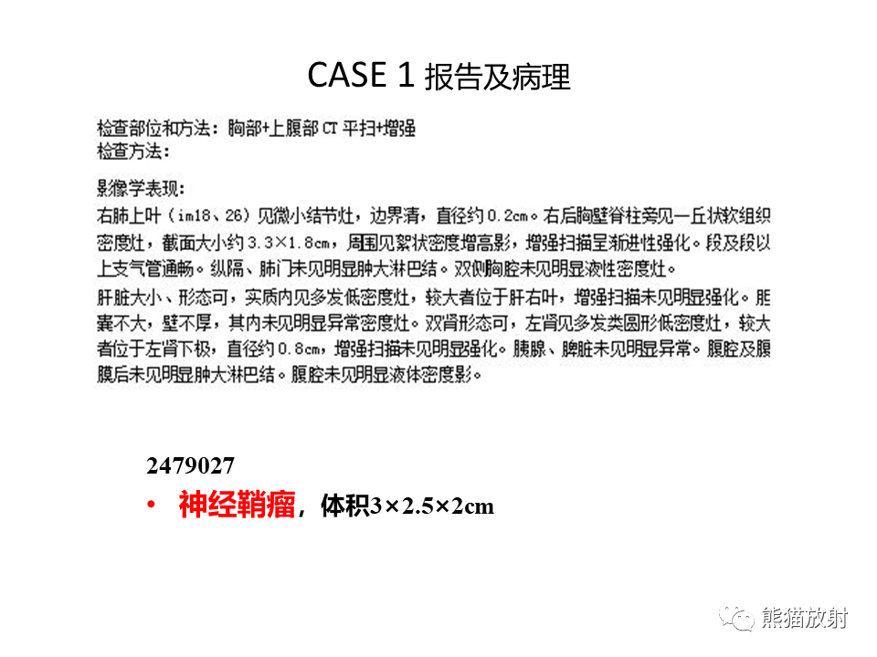 影像PPT - 【病例】胸壁神经鞘瘤2例CT影像-18