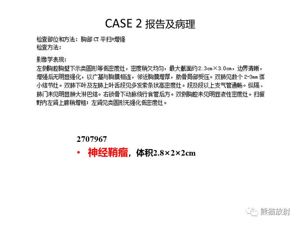 影像PPT - 【病例】胸壁神经鞘瘤2例CT影像-19