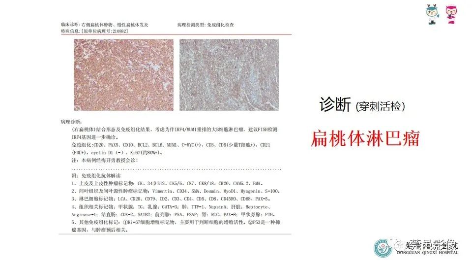 影像PPT - 【PPT】扁桃体淋巴瘤的影像诊断-10