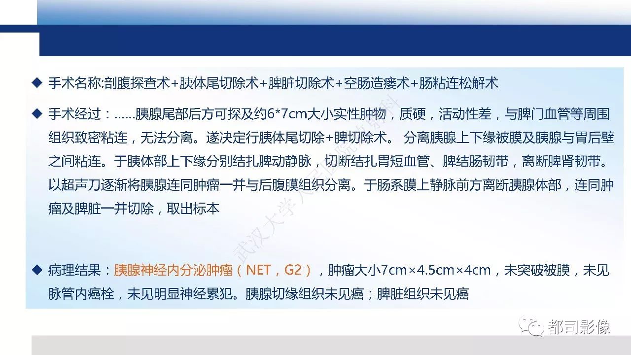 影像PPT - 【病例】胰腺神经内分泌肿瘤肝转移1例CT及MR-16