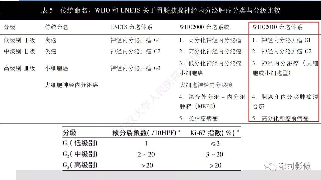 影像PPT - 【病例】胰腺神经内分泌肿瘤肝转移1例CT及MR-18