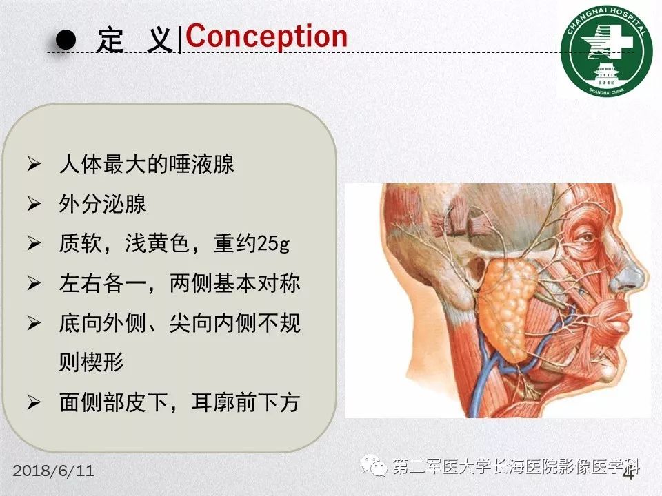 影像PPT - 【PPT】腮腺常见疾病-4