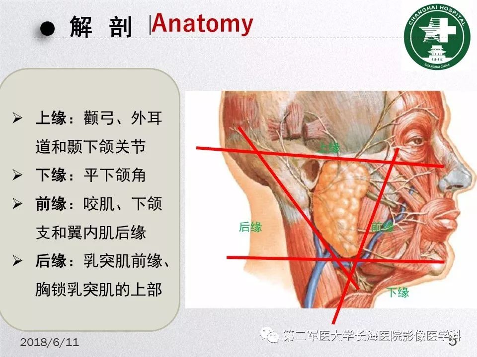 影像PPT - 【PPT】腮腺常见疾病-5
