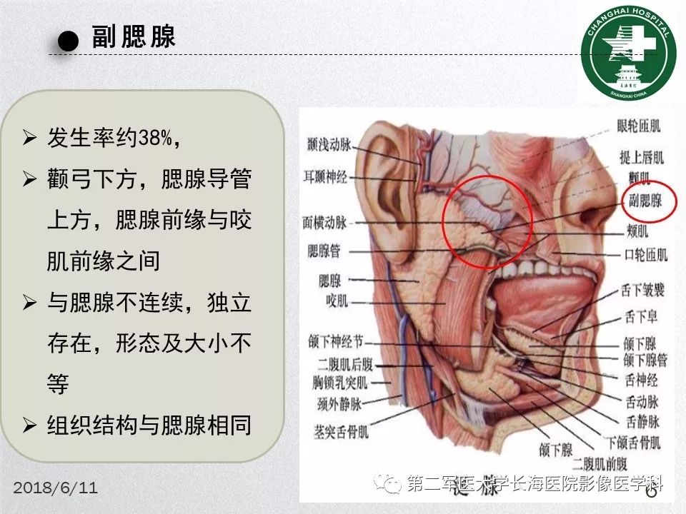 影像PPT - 【PPT】腮腺常见疾病-6