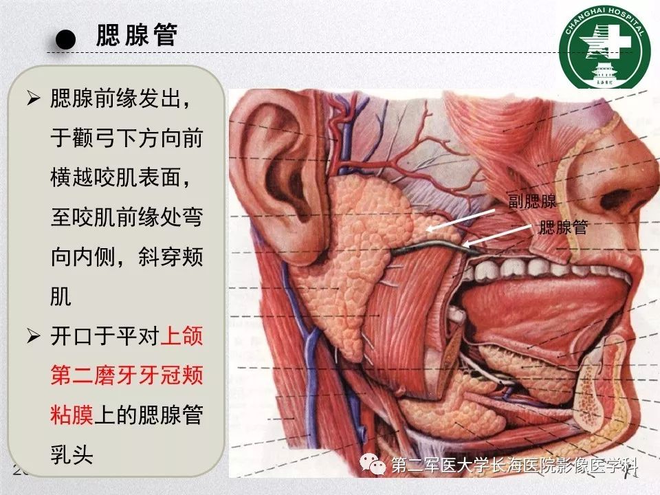 影像PPT - 【PPT】腮腺常见疾病-7