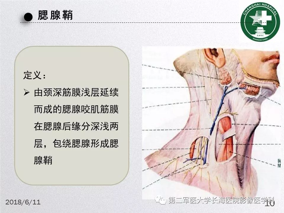 影像PPT - 【PPT】腮腺常见疾病-10